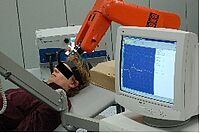 Roboter Gestützte TMS Behandlung